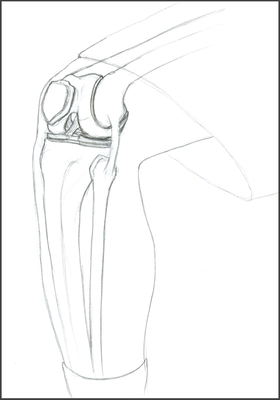 Sketch of the Knee Joint, Anterior Lateral View
