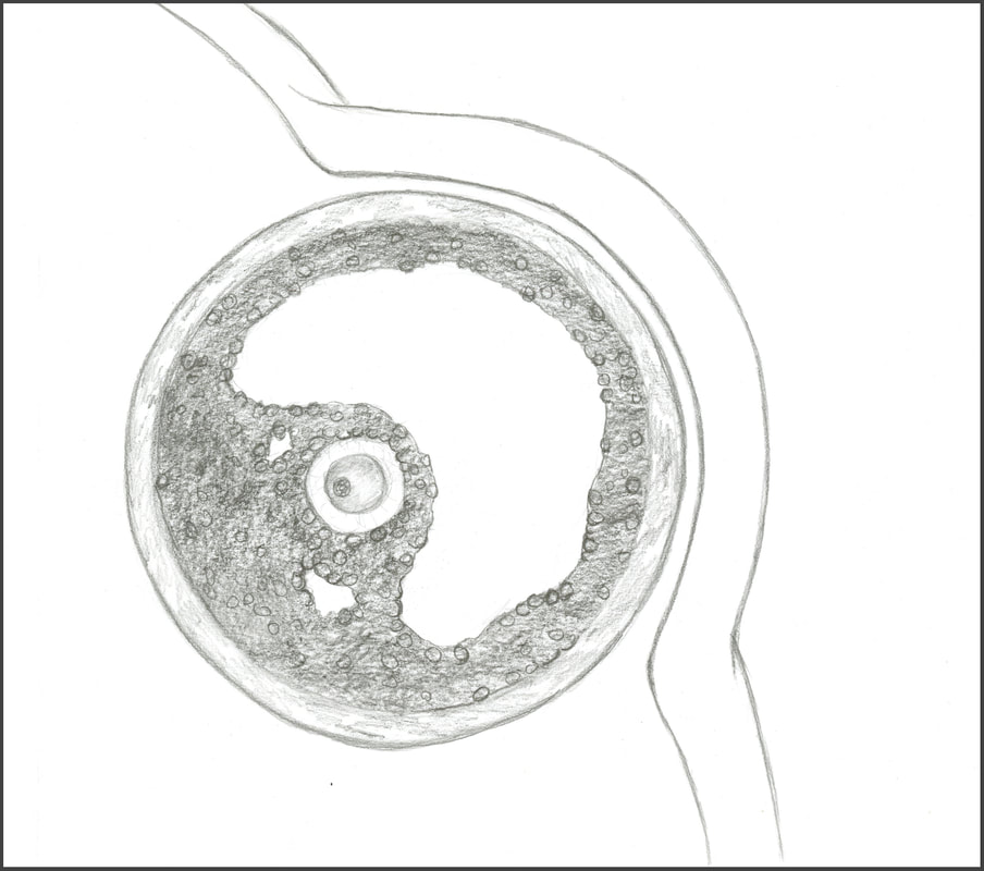 Mature follicle of the human ovary