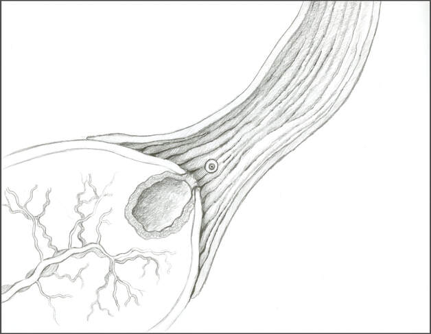 Ovulation sketch by Amanda Barnaby